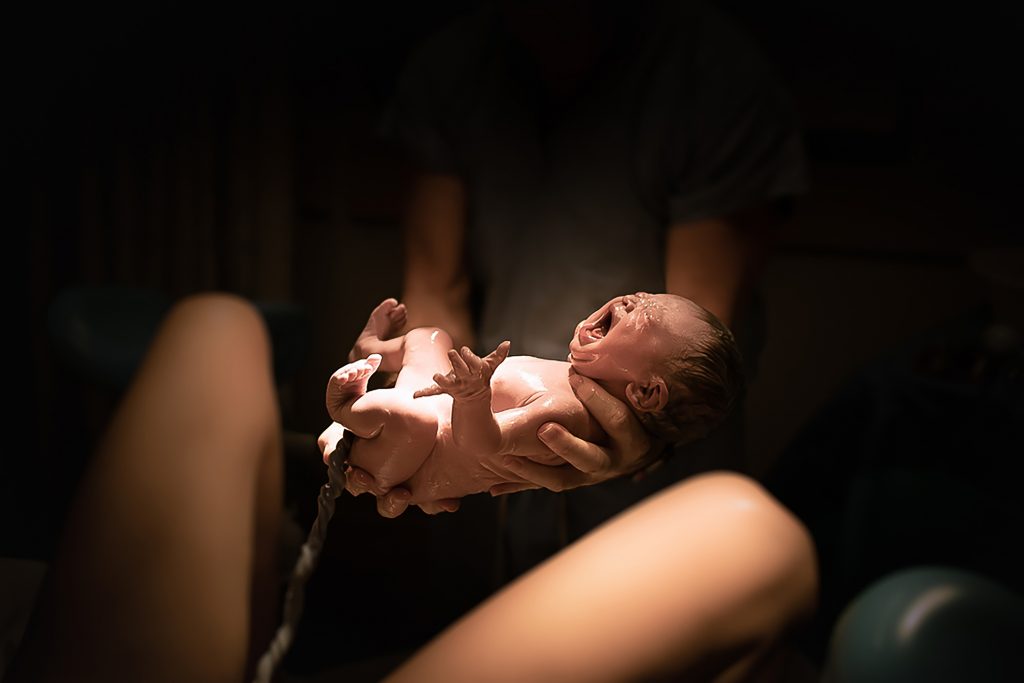 Labor in the hospital. Baby being born in vaginal delivery. Vaginal birth.