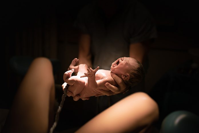 Labor in the hospital. Baby being born in vaginal delivery. Vaginal birth.