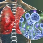 Heart Damage Link to COVID-19 Shots: Tip of the Iceberg? – Commentary