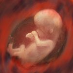 Doctors Make Strides in Treating Infants with Genetic Disorders
